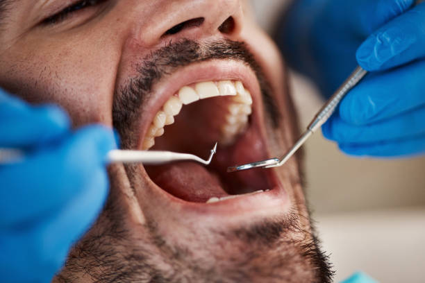 Best Dentist for Tooth Abscess  in Ross, CA